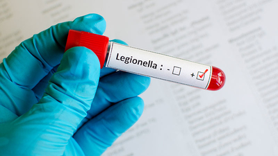 Legionella Test